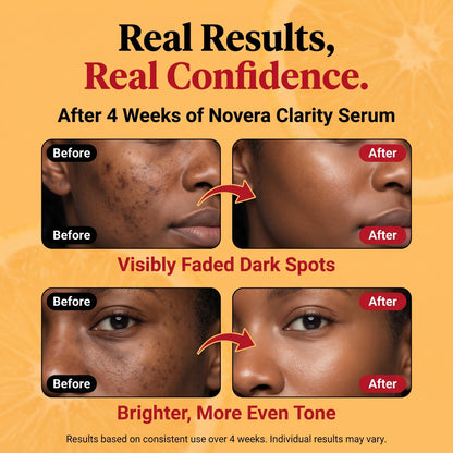 Novera Clarity Ritual®